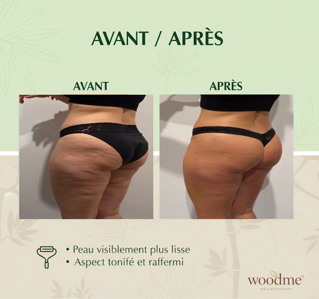 Woodme - Kit de madérothérapie